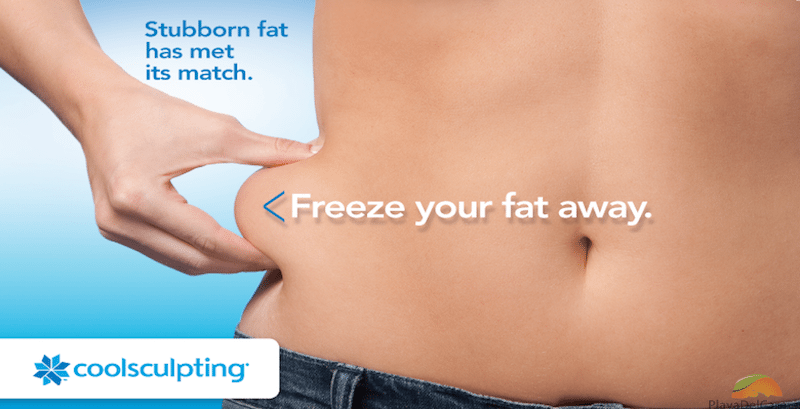 coolsculpting